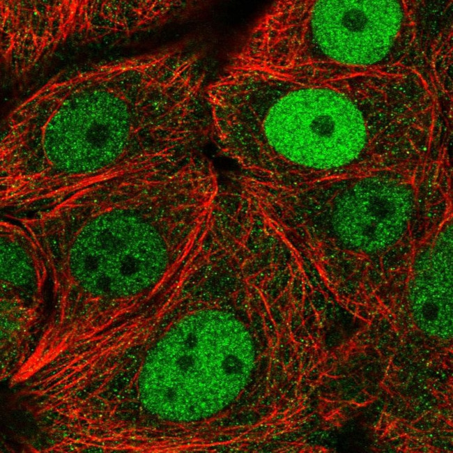 MCM2 Antibody in Immunocytochemistry (ICC/IF)