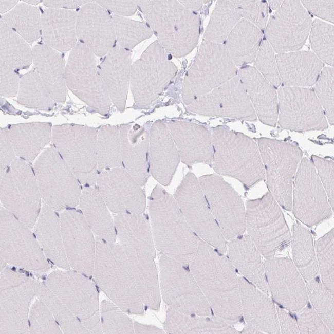 PMEL Antibody in Immunohistochemistry (Paraffin) (IHC (P))