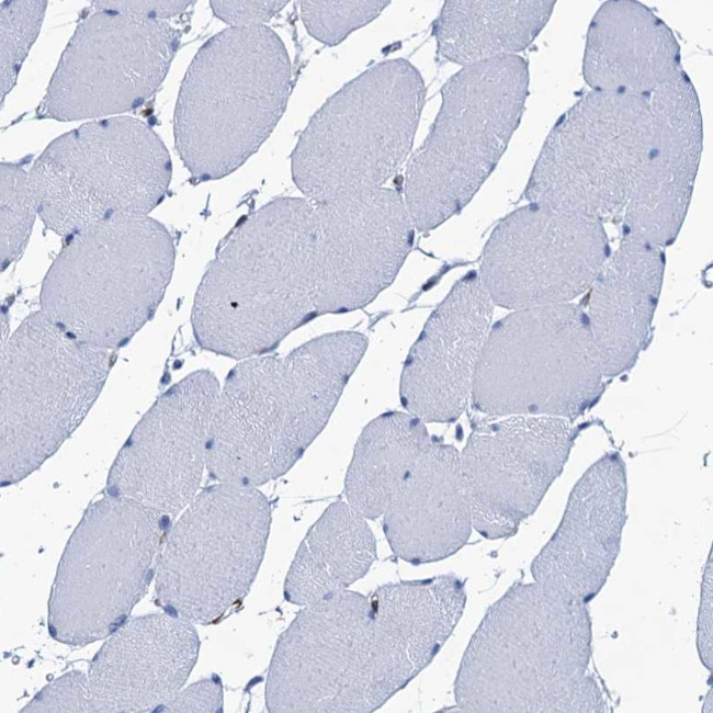 MYLK Antibody in Immunohistochemistry (Paraffin) (IHC (P))