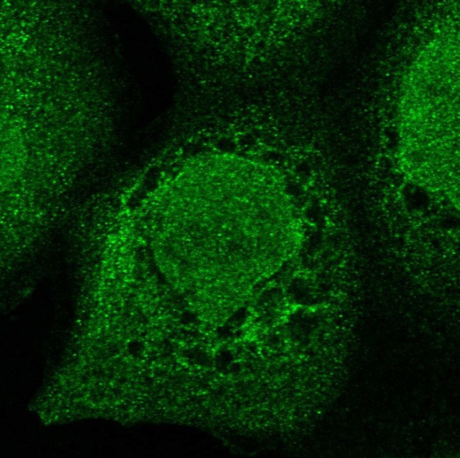 ZMYM2 Antibody in Immunocytochemistry (ICC/IF)