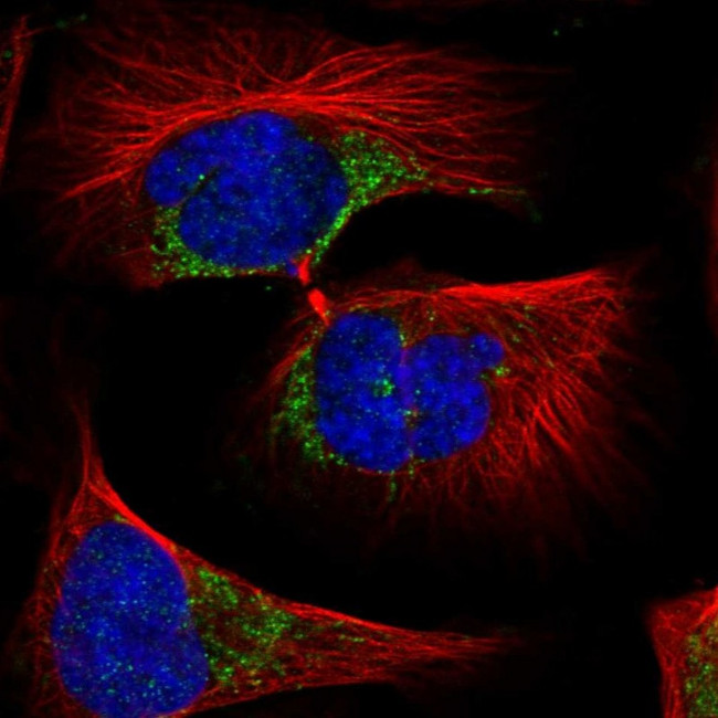 SLC11A2 Antibody in Immunocytochemistry (ICC/IF)