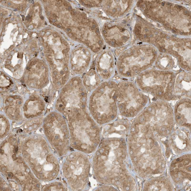 DDIT4 Antibody in Immunohistochemistry (Paraffin) (IHC (P))