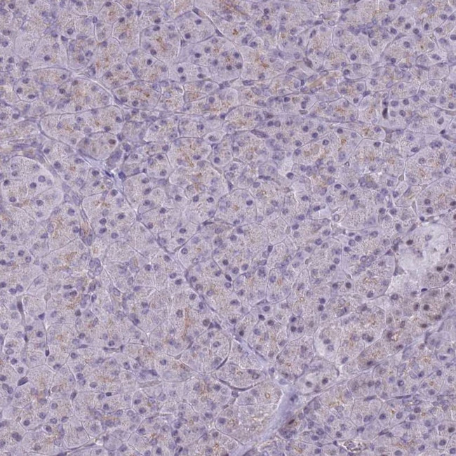 beta Adducin Antibody in Immunohistochemistry (Paraffin) (IHC (P))