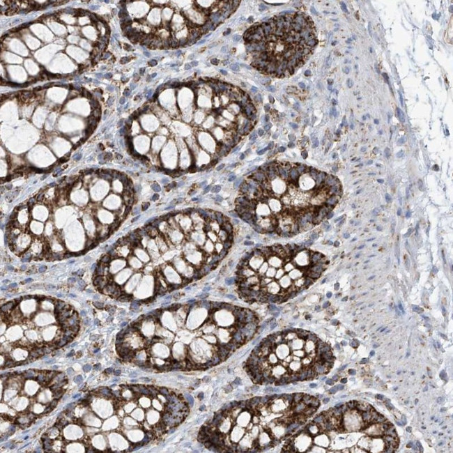 PNPase Antibody in Immunohistochemistry (Paraffin) (IHC (P))