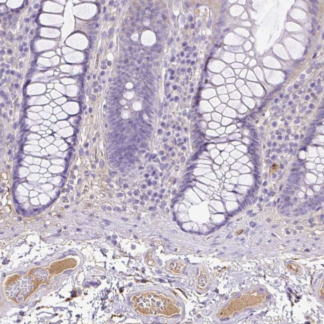 Tetranectin Antibody in Immunohistochemistry (Paraffin) (IHC (P))