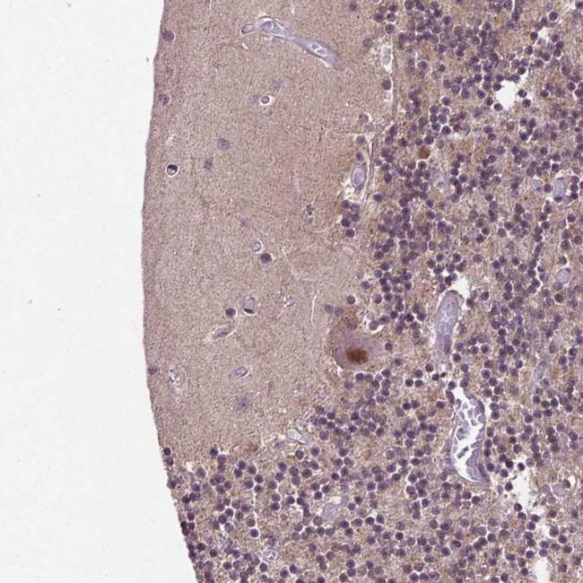 UBA3 Antibody in Immunohistochemistry (Paraffin) (IHC (P))