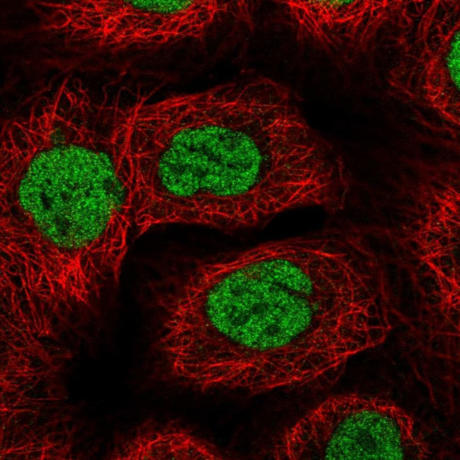 BACH1 Antibody in Immunocytochemistry (ICC/IF)