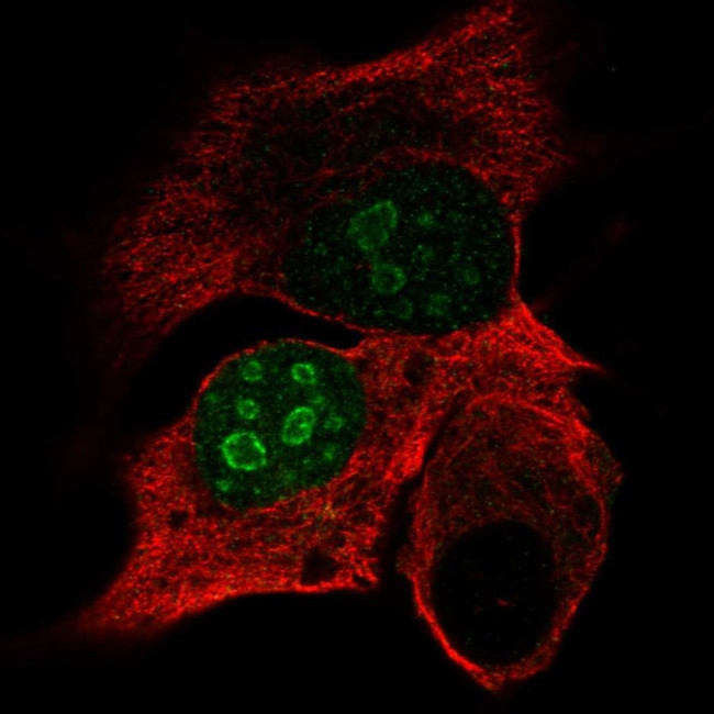 DPPA4 Antibody in Immunocytochemistry (ICC/IF)