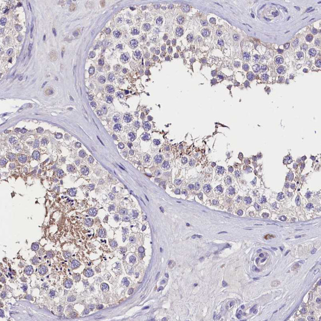 CGI58 Antibody in Immunohistochemistry (Paraffin) (IHC (P))