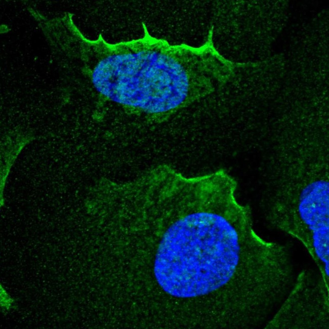 alpha Adducin Antibody in Immunocytochemistry (ICC/IF)