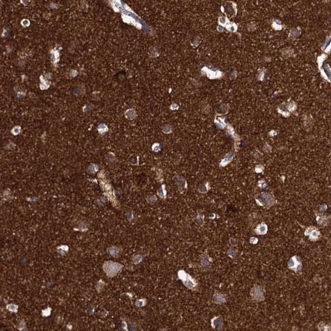 beta Synuclein Antibody in Immunohistochemistry (Paraffin) (IHC (P))