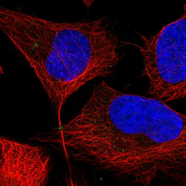 PPAT Antibody in Immunocytochemistry (ICC/IF)