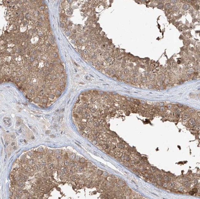 PPAT Antibody in Immunohistochemistry (Paraffin) (IHC (P))