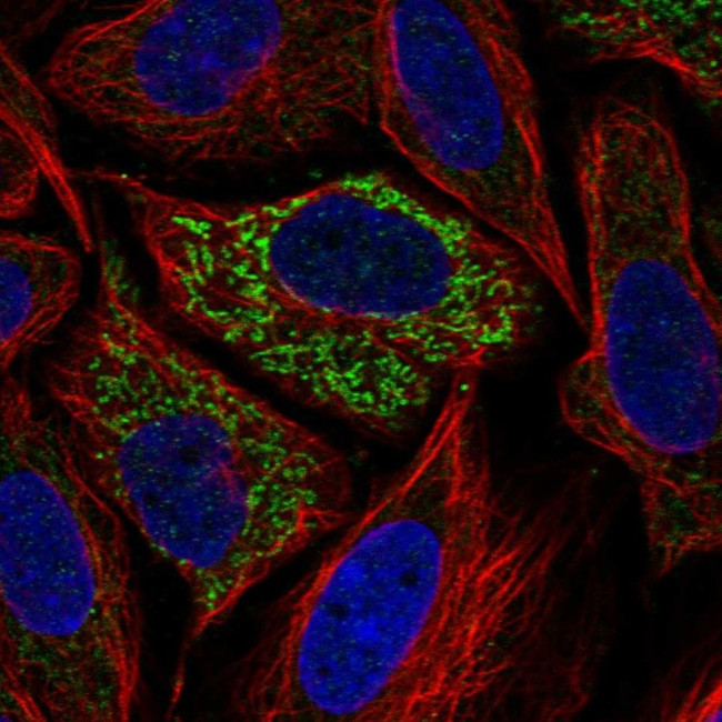 Glutaminase Antibody in Immunocytochemistry (ICC/IF)