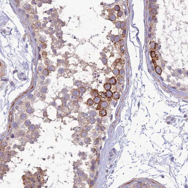 CD103 Antibody in Immunohistochemistry (Paraffin) (IHC (P))