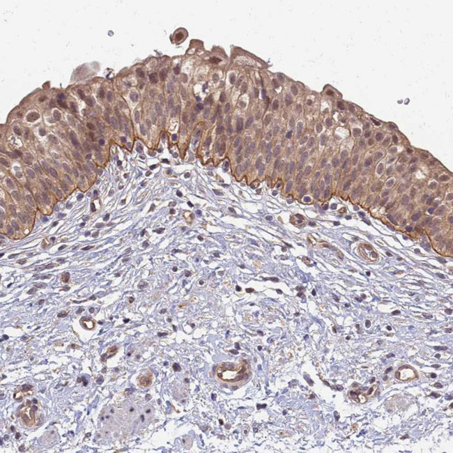 CD104 Antibody in Immunohistochemistry (Paraffin) (IHC (P))