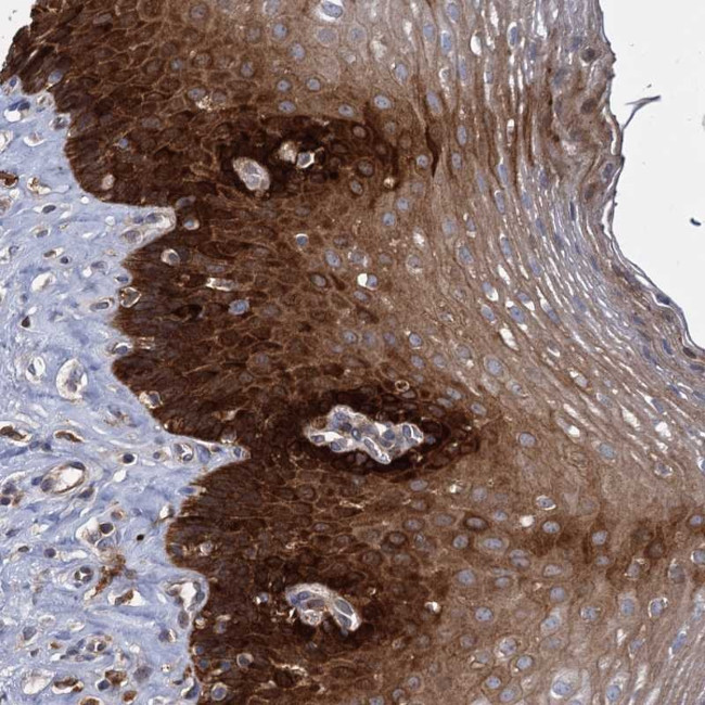 GCLC Antibody in Immunohistochemistry (Paraffin) (IHC (P))