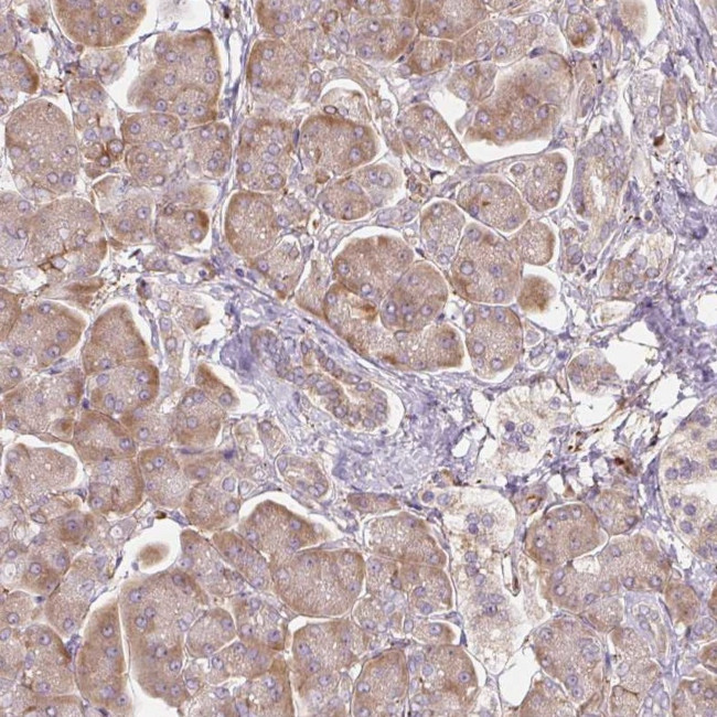 RASA1 Antibody in Immunohistochemistry (Paraffin) (IHC (P))