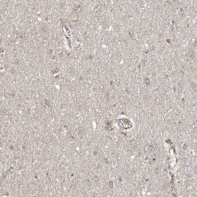 EHHADH Antibody in Immunohistochemistry (Paraffin) (IHC (P))