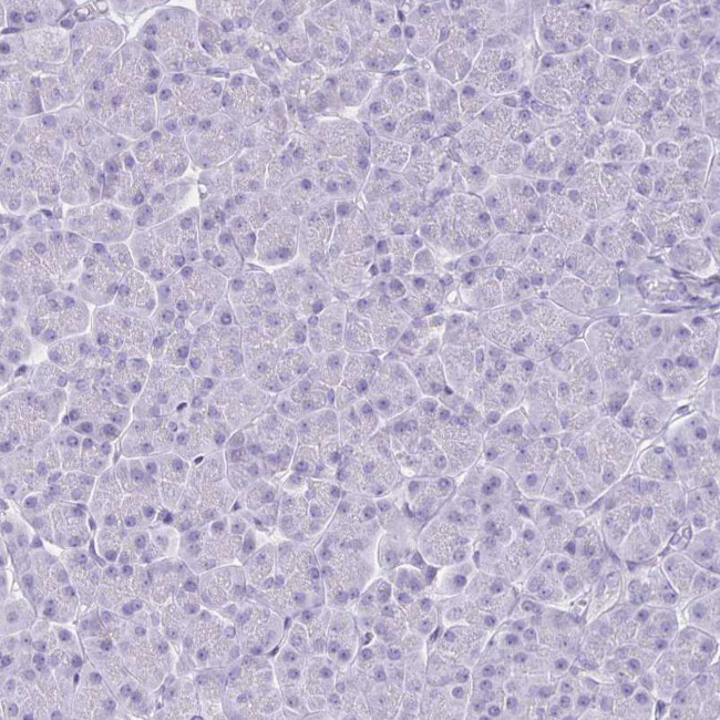 HOMER1 Antibody in Immunohistochemistry (Paraffin) (IHC (P))