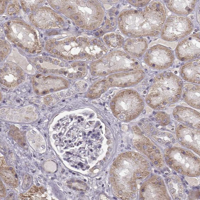 SLC4A5 Antibody in Immunohistochemistry (Paraffin) (IHC (P))