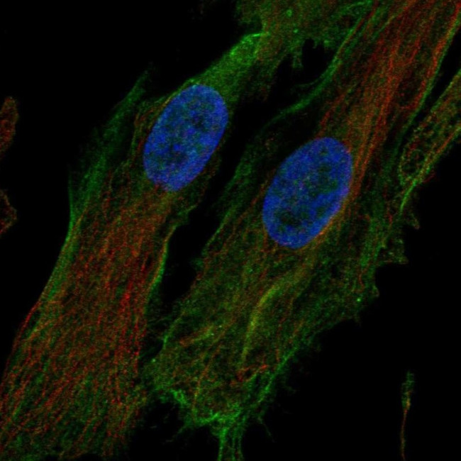 HTRA1 Antibody in Immunocytochemistry (ICC/IF)