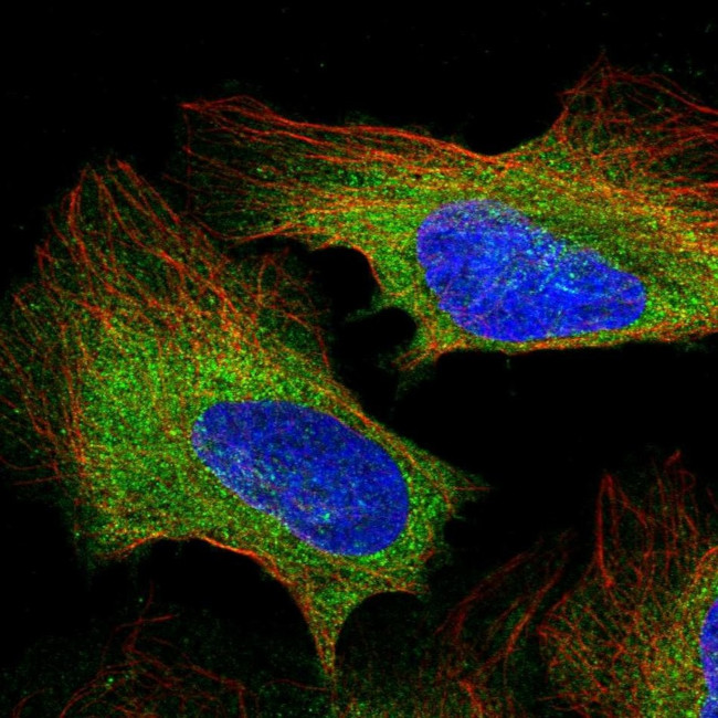 PLCG1 Antibody in Immunocytochemistry (ICC/IF)