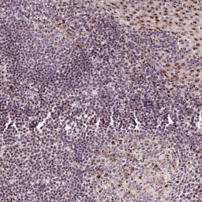 Nucleostemin Antibody in Immunohistochemistry (Paraffin) (IHC (P))