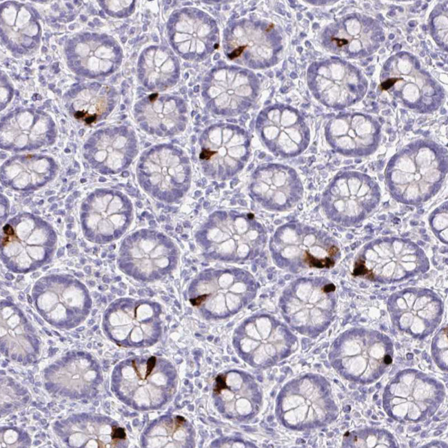 Glucagon Antibody in Immunohistochemistry (Paraffin) (IHC (P))