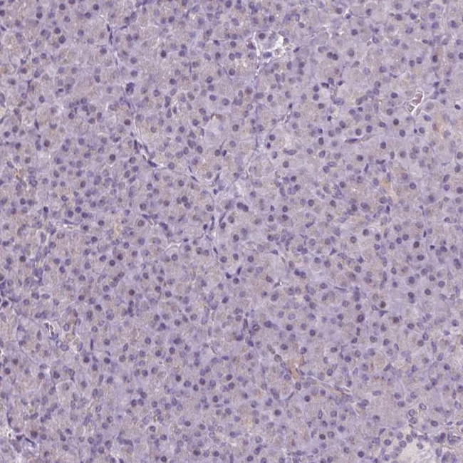 Neurocan Antibody in Immunohistochemistry (Paraffin) (IHC (P))