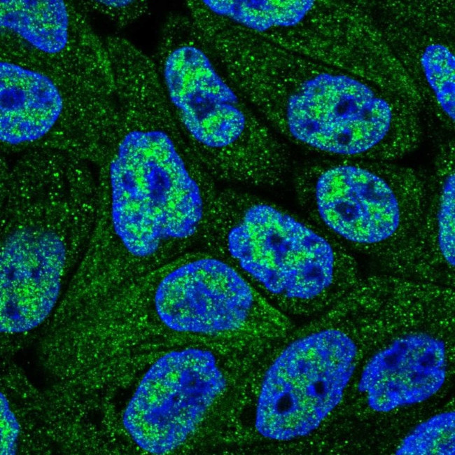 CNDP2 Antibody in Immunocytochemistry (ICC/IF)