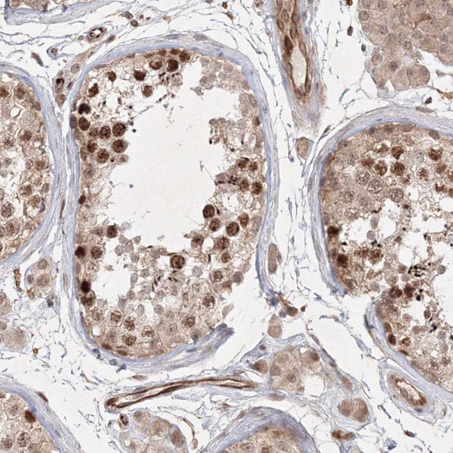 KIF20A Antibody in Immunohistochemistry (Paraffin) (IHC (P))