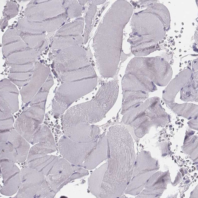 PDE8B Antibody in Immunohistochemistry (Paraffin) (IHC (P))