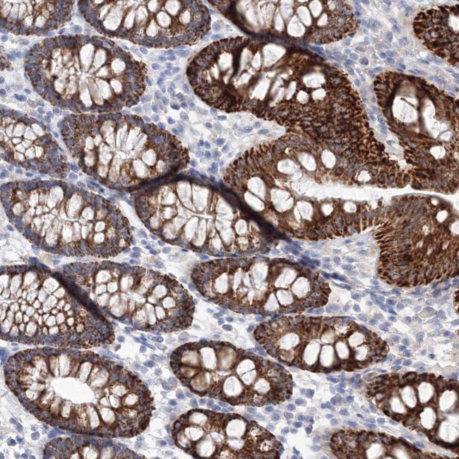 HMGCS1 Antibody in Immunohistochemistry (Paraffin) (IHC (P))