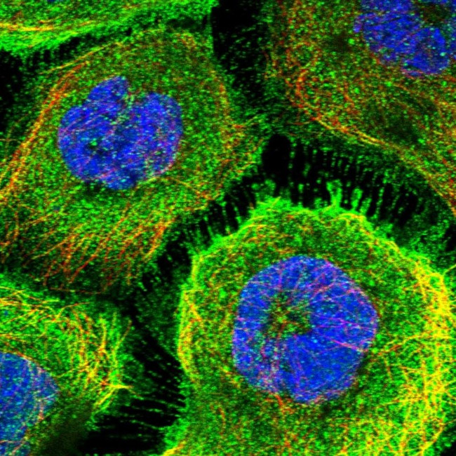 AADAT Antibody in Immunocytochemistry (ICC/IF)