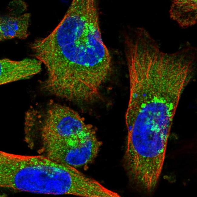 COPD Antibody in Immunocytochemistry (ICC/IF)