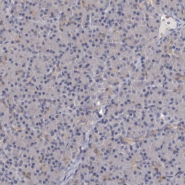 GST Omega 1 140A Antibody in Immunohistochemistry (Paraffin) (IHC (P))