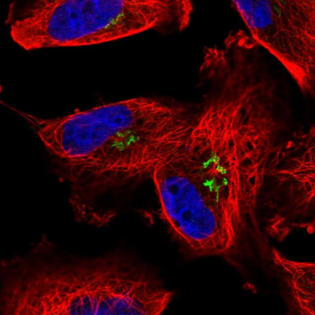 Arylsulfatase B Antibody in Immunocytochemistry (ICC/IF)