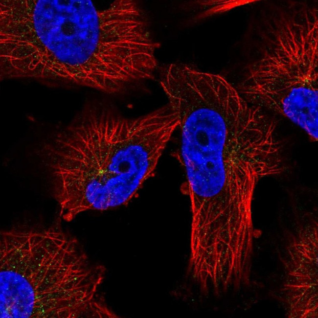 PRKAR2A Antibody in Immunocytochemistry (ICC/IF)