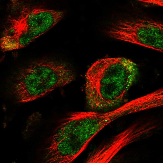 HOXC11 Antibody in Immunocytochemistry (ICC/IF)