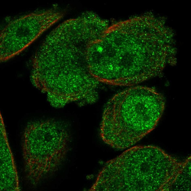 Adenosine Kinase Antibody in Immunocytochemistry (ICC/IF)