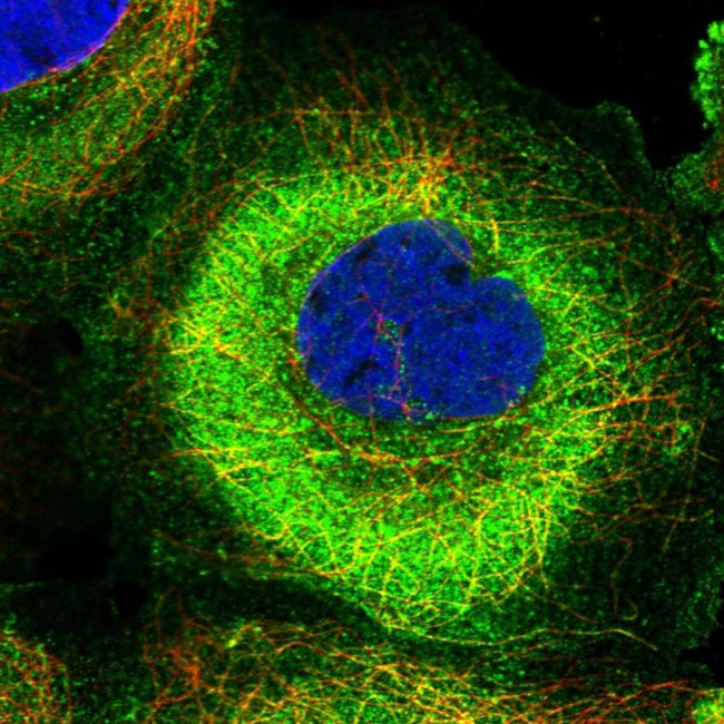 MADD Antibody in Immunocytochemistry (ICC/IF)