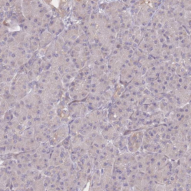 Cdc25B Antibody in Immunohistochemistry (Paraffin) (IHC (P))