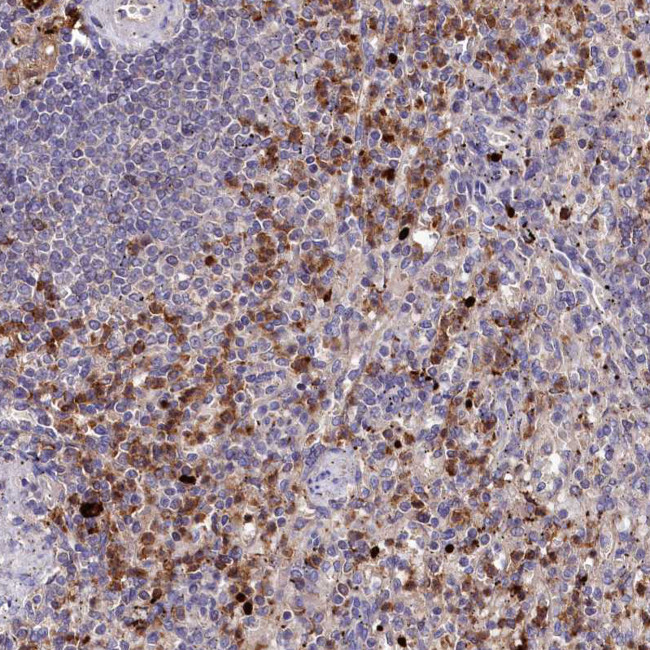 KLRB1 Antibody in Immunohistochemistry (Paraffin) (IHC (P))