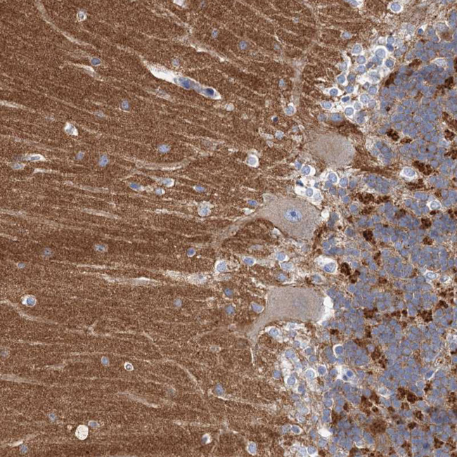 NALP10 Antibody in Immunohistochemistry (Paraffin) (IHC (P))