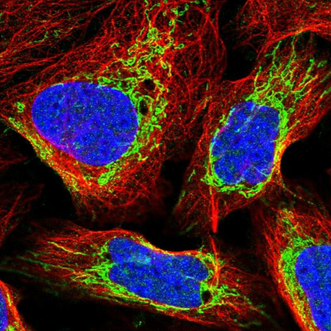 EXOSC8 Antibody in Immunocytochemistry (ICC/IF)