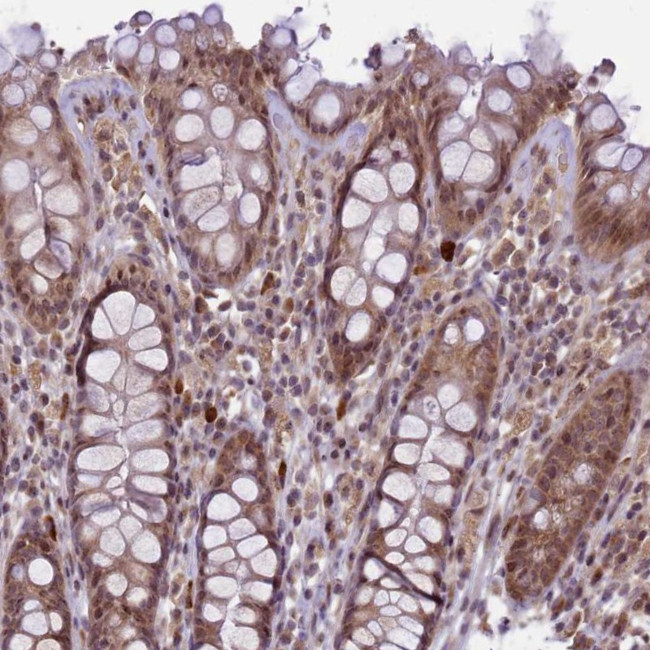 CtIP Antibody in Immunohistochemistry (Paraffin) (IHC (P))