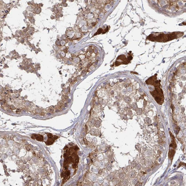 CCS Antibody in Immunohistochemistry (Paraffin) (IHC (P))