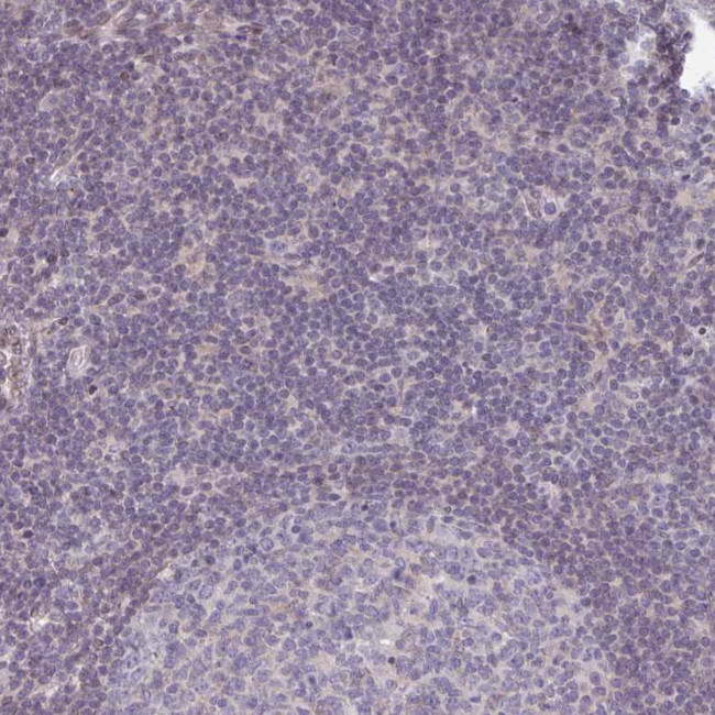 Glypican 5 Antibody in Immunohistochemistry (Paraffin) (IHC (P))