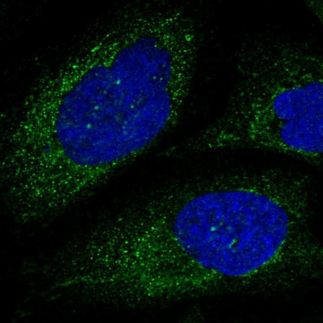 Calpain 6 Antibody in Immunocytochemistry (ICC/IF)